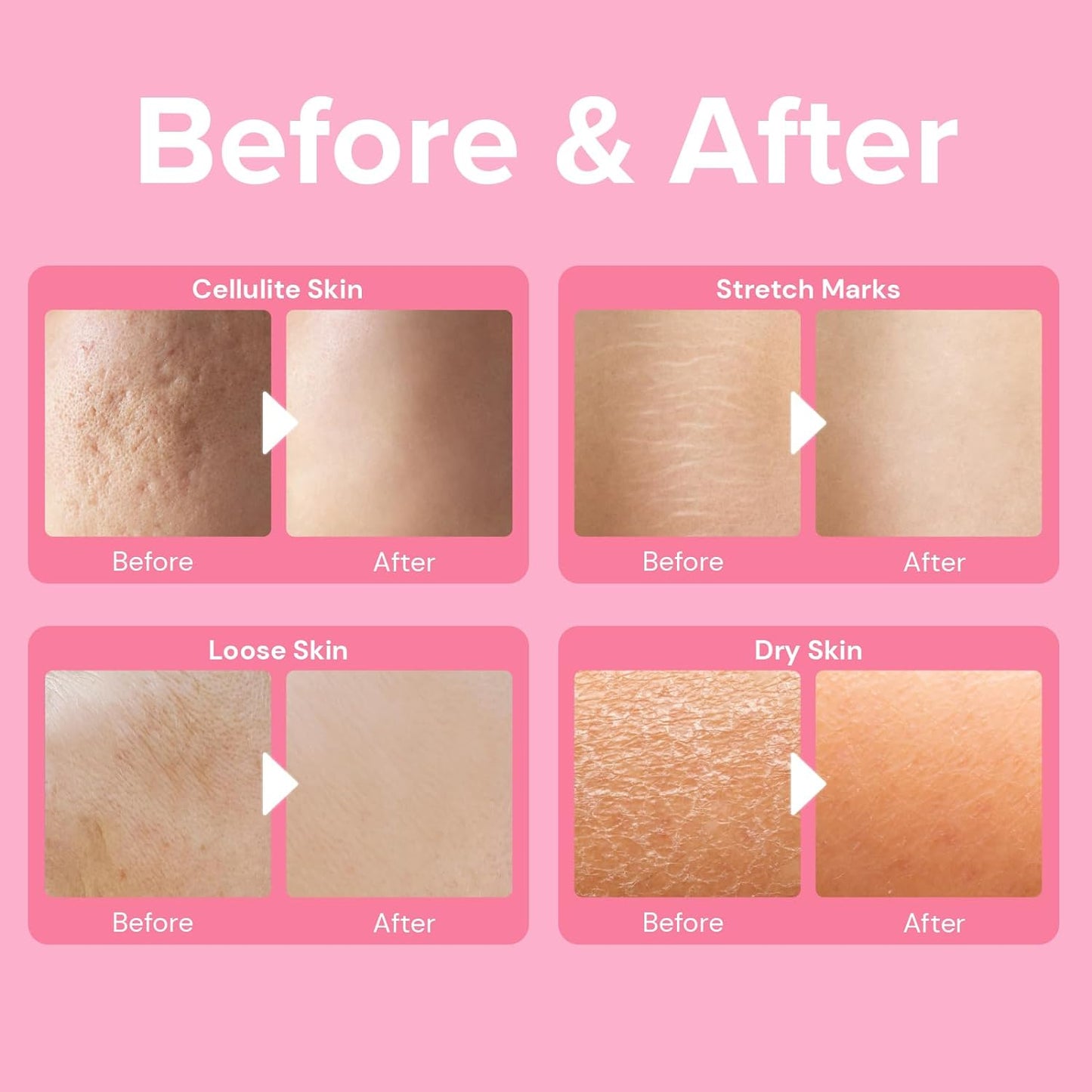 Anti Cellulite Body Firming Cream: Tightening & Lifting Booty Lotion with 3D Thermal Tech for Thighs, Belly, Bum & Women Sagging Skin, Shea Butter & Coconut Oil, 3.4 oz